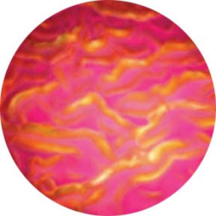 gobo 33103 - Ripple-Magenta