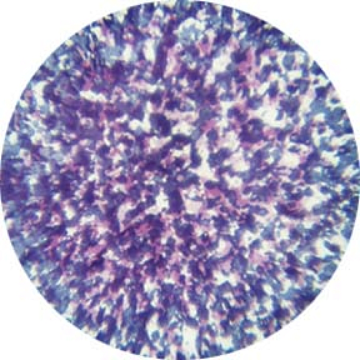 gobo 55004 - Blue and Lavender